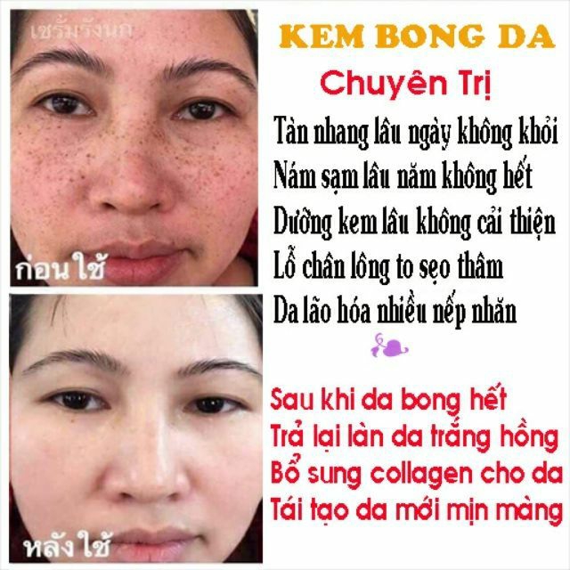 [Hcm]Kem Kích Bong Da Thailan