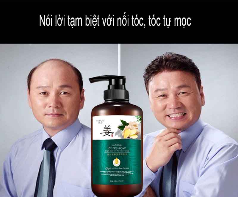 Dung Dịch Dưỡng Tóc Gừng 500Ml Thúc Đẩy Nhanh Chống Quá Trình Mọc Tóc Dầu Gội Đầu Ngăn Ngừa Rụng Tóc Cải Thiện Nang Tóc Nuôi Dưỡng Chân Tóc Chăm Sóc