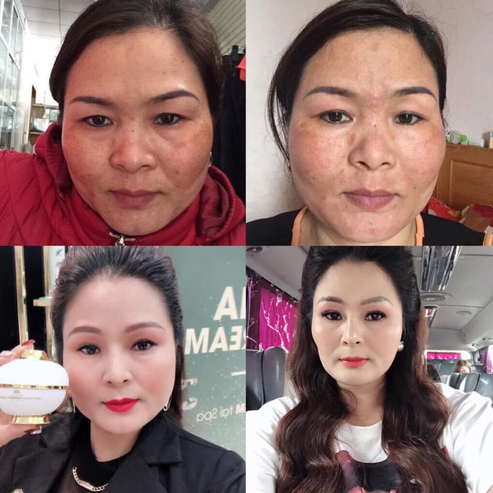 Cao Nám Magicskin