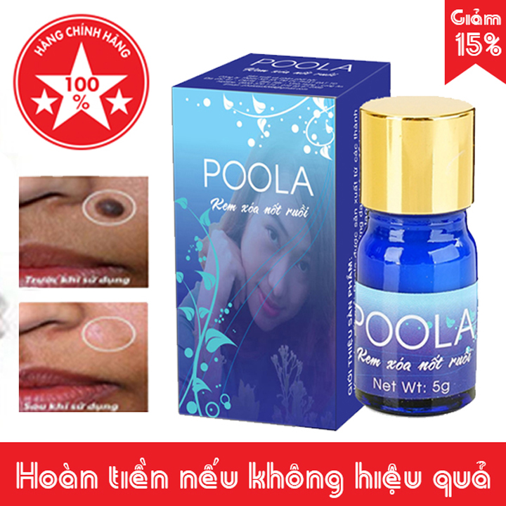 Kem Tẩy Nốt Ruồi Poola Chính Hãng