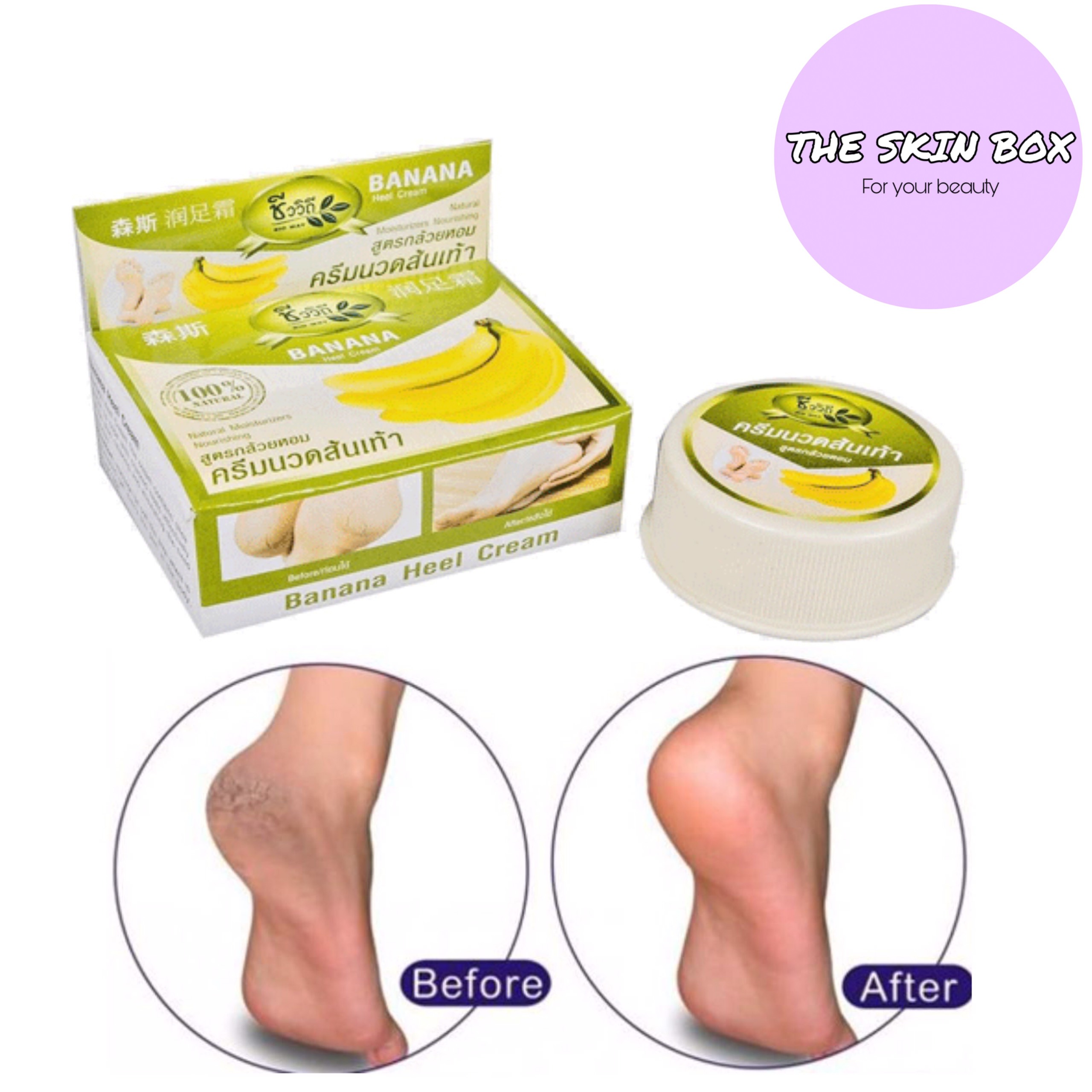 Kem Nứt Gót Chân Chuối Banana Heel Thailand