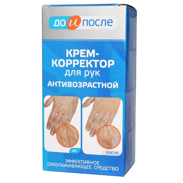 [Hcm]Kem Xóa Nếp Nhăn Nổi Gân Và Lão Hóa Da Tay Kpem Koppektop 100Ml