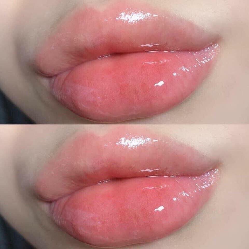 [HCM]Hồng môi Nuwhite L1a