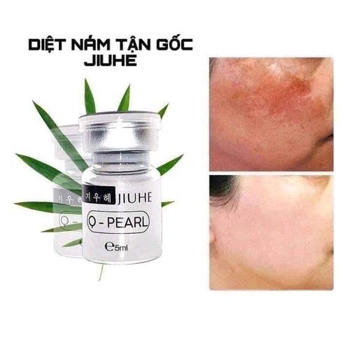 [Hcm]Serum Giam Thâm Bodythâm Mắtthâm Nách Đầu Gốicánh Taymắt Cá Và Face Giúp Bạn Lấy Lại Làn Da Trắng Sáng Tự Nhiên Hiệu Quả