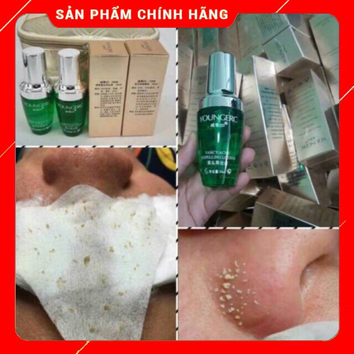 [Hcm][Sale] Tinh Chất Ủ Mụn Mới 2021 50Ml