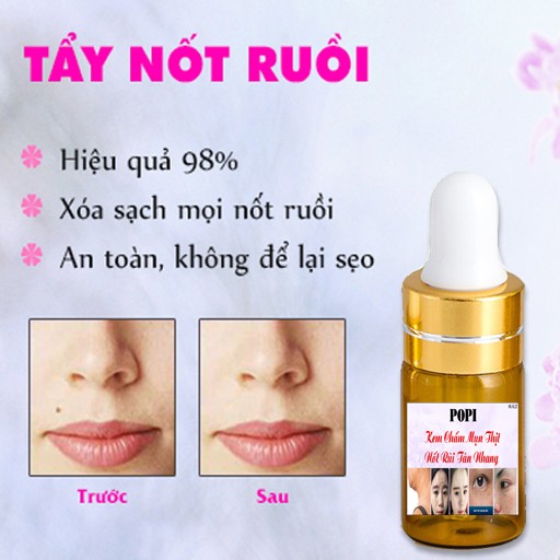 Kem Đốt Nốt Ruồi Mụn Thịttàn Nhang Đồi Mồi Hiệu Quả Sau 7 Ngày