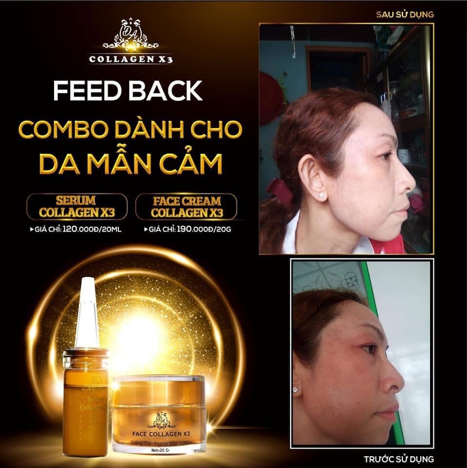 Combo Kem face và Serum collagen X3