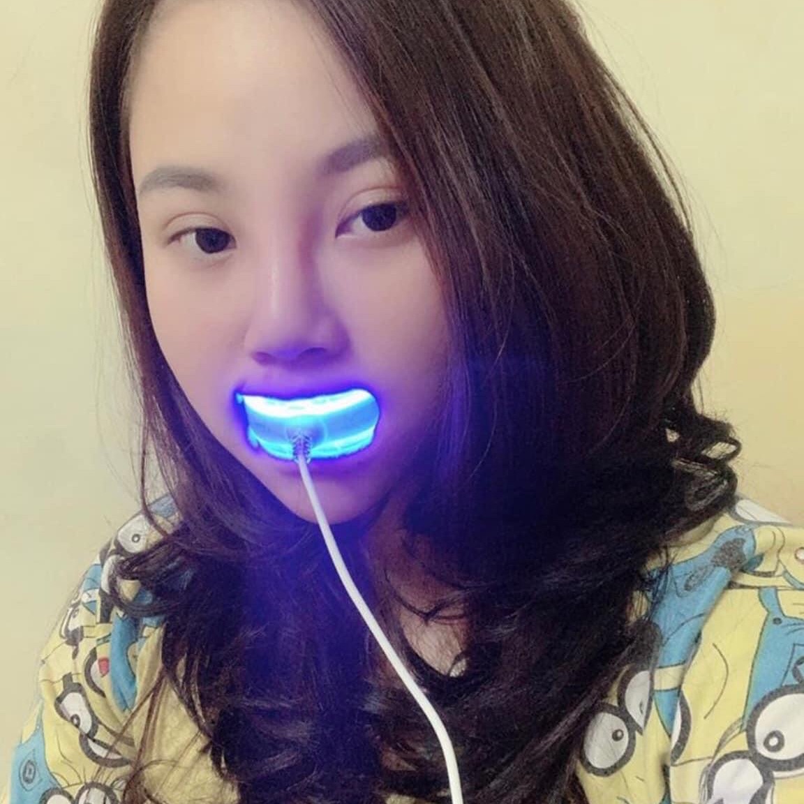 Máy Làm Trắng Răng Thương Hiệu Nhật Bản