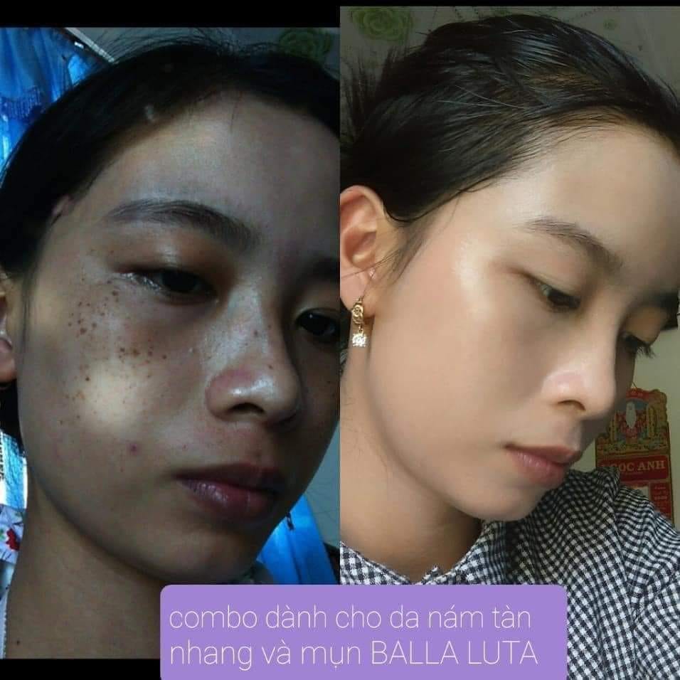 cao nám Balla Luta chính hãng