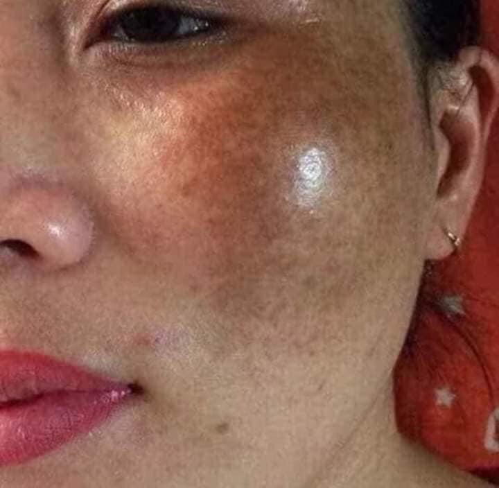 Kem nám trắng da elbon hàn quốc
