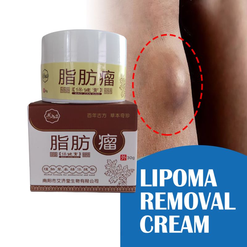 Lipoma Removal Cream Removal Fat Granule Swelling Cellulite Multiple Single Lipoma Treat Tumor Hard Block Subcutaneous Lipoma Lump Bulge Ointment