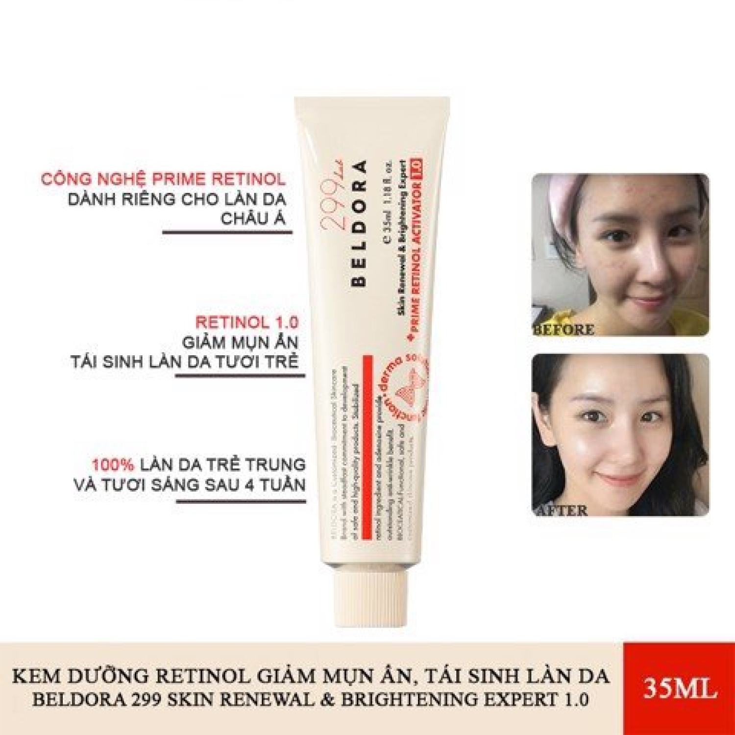 Kem Dưỡng Retinol BELDORA 299 Prime chống lão hóa ngăn ngừa nếp nhăn 35ml