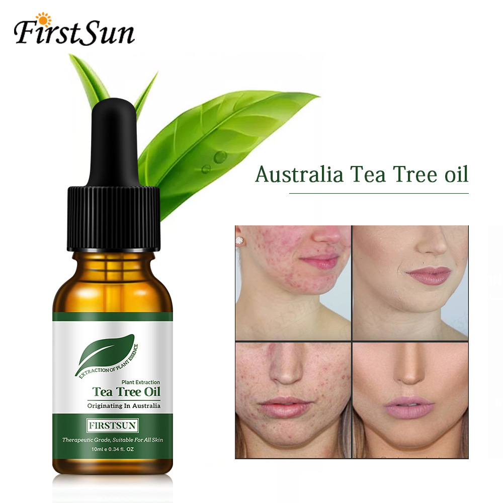 Tinh Dầu Tràm Trà Giảm Mụn Thâm Tea Tree Oil/Mụn Đầu Đen/Mụn Thâm/Cho Nam 10Ml