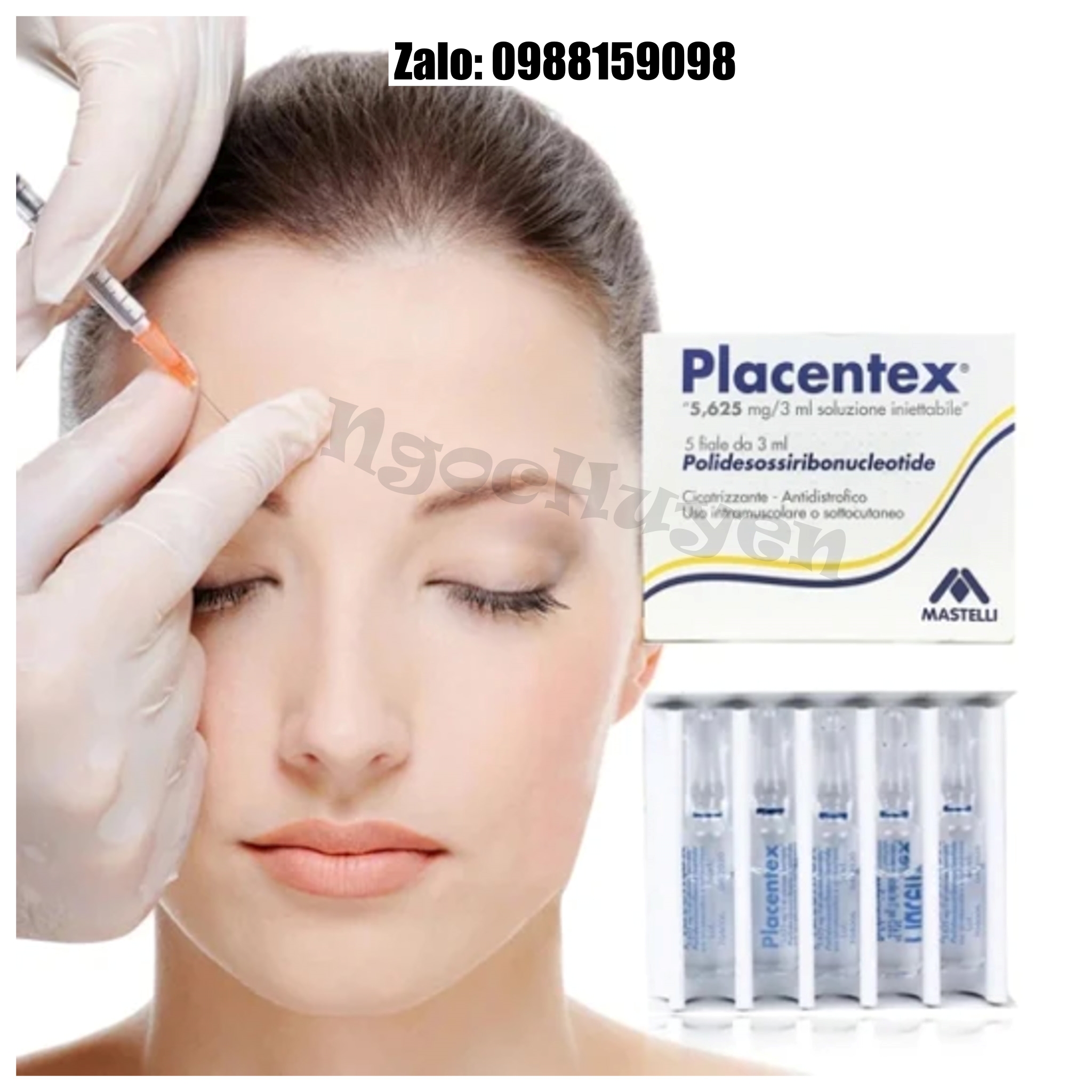 Tinh chất căng bóng da tiêm meso DNA cá hồi Placentex - 1hộp 5 ống 3ml