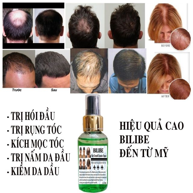 [Hcm]Serum Mọc Tóc Dài Tóc Nam Nữ