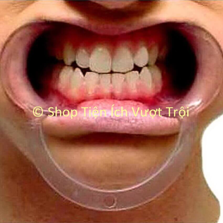 Cái banh mở rộng miệng môi hình chữ C giữ miệng mở để rảnh tay thao tác trong khoang miệng dễ dàng-Tiện Ích Vượt Trội