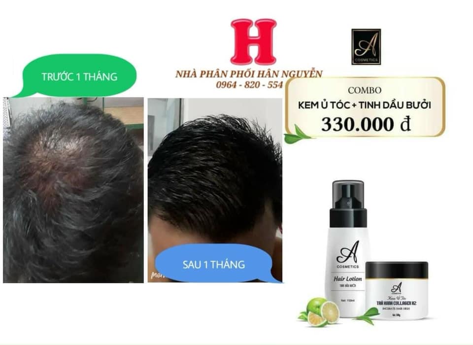 [Hcm]Combo Trị Rụng Tóc A Cosmectics