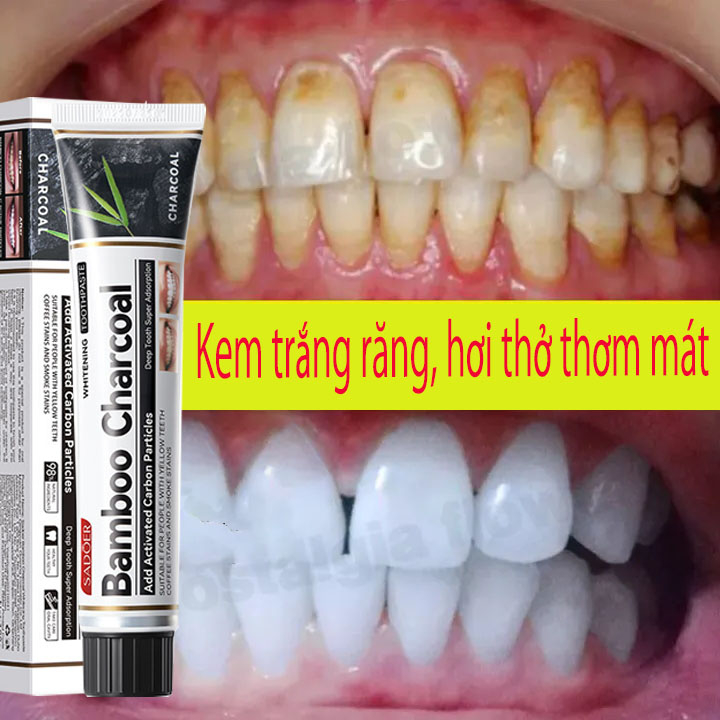 Kem đánh răng than tre Kem đánh răng làm trắng răng Kem đánh răng than hoạt tính BAMBOO CHARCOAL TOO