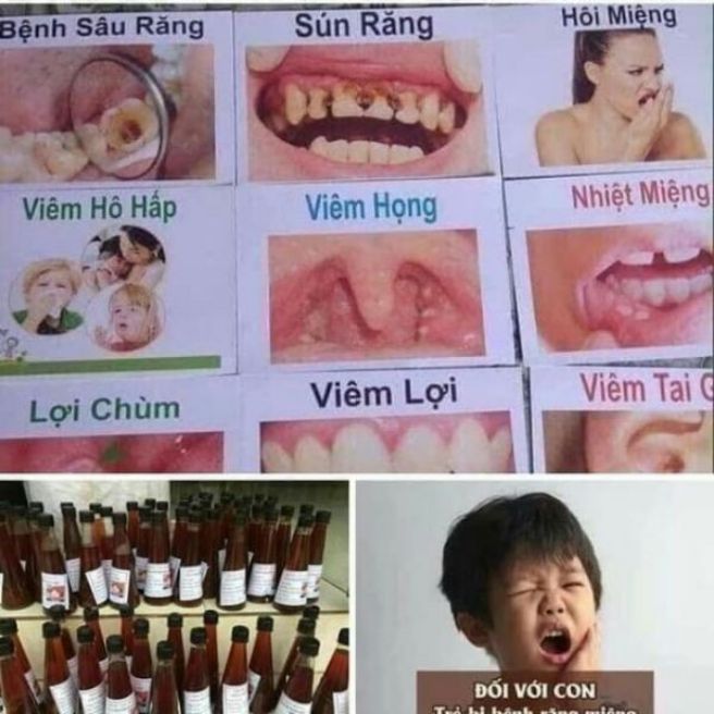 Sỉ Toàn Quốc Chai Thuoc Dac Tri Sâu Răng