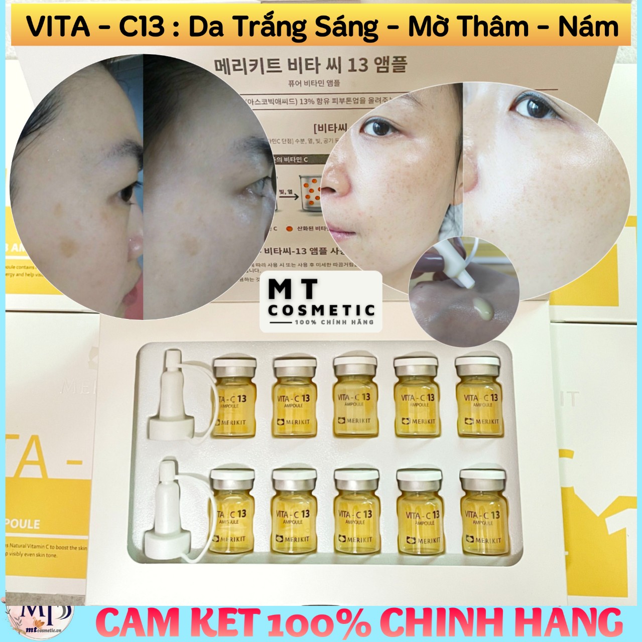 Tinh Chất Trắng Da Vita - C13 Hàn Quốc - Làm Mờ Dần Các Vệt Nám Sạm Da Tối Màu - Giúp Da Trắng Sáng Giảm Nám Đốm Nâu