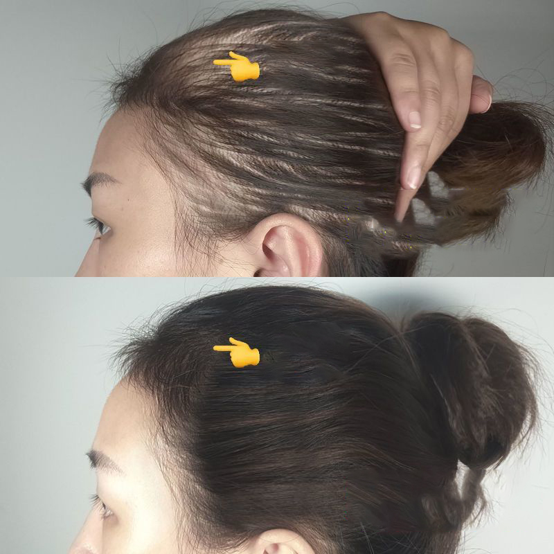 【Hàng Chính Hãng】Chất Lỏng Mọc Tóc Chống Rụng Tóc Dầu Gội Gừng【500Ml】 Dầu Gọi Thảo Dược Tươi Mát Không Nhờn Gốc Tóc Vững Chắc Và Khỏe Mạnh