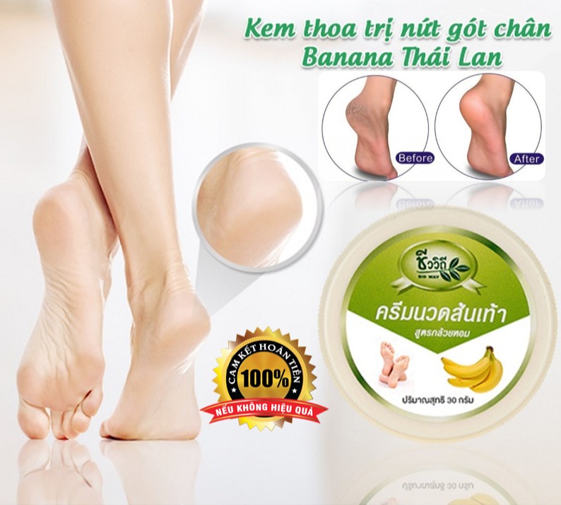 [Hcm]Kem Nứt Nẻ Gót Chân Banana Cream Heels Thái Lan 30G