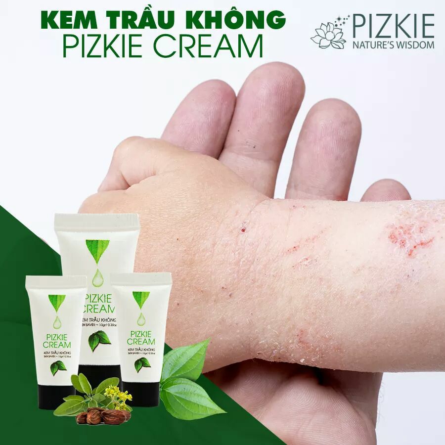[Mua Tuýp Lớn Tặng Tuýp Nhỏ] Kem Trầu Không Tác Dụng Giảm Ngứa 50Gr