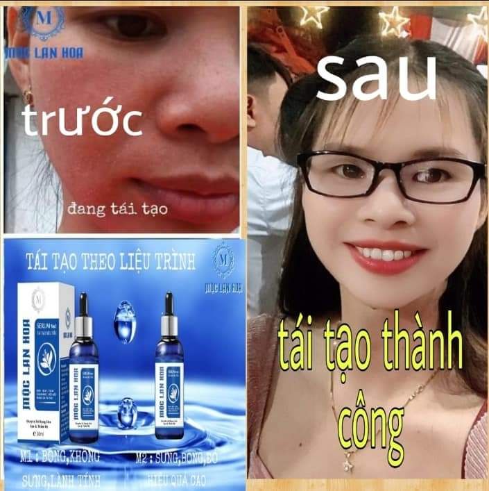 Serum 9 In 1 Tái Tạo Da Siêu Tốc - Mộc Lan Hoa 280K/30Ml.