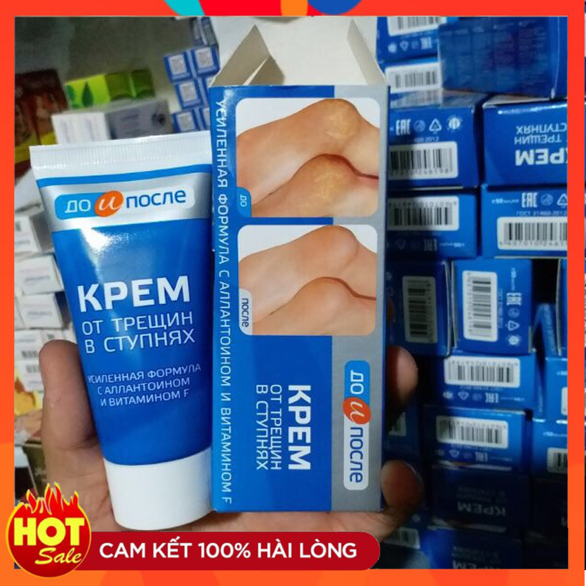 [Hàng Auth] Kem Chống Nứt Gót Chân Nga Kpem Foot Cream 50Ml Hết Nẻ 100% - Hạnh Phúc Homecare