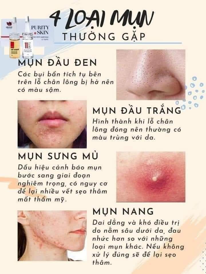 Tinh Chất Trị Mụn Và Trị Thâm ??? ???????? ??????????? ??% + ???? ?% Chuẩn Pháp