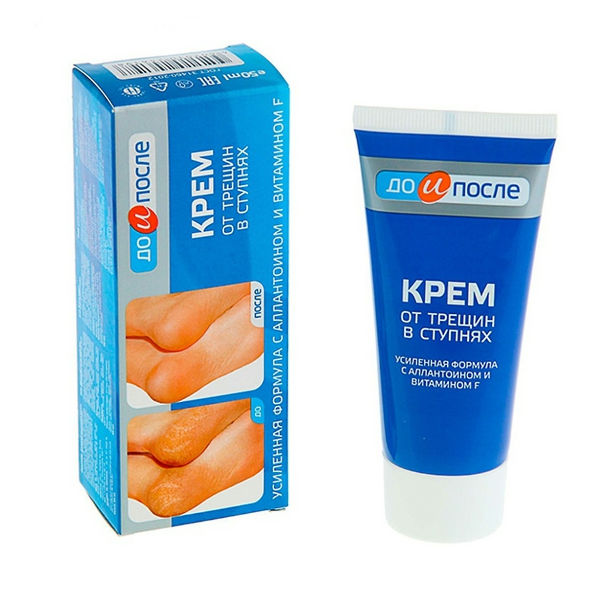 [Hcm]Kem Dưỡng Loại Bỏ Nứt Gót Chân Kpem Cream For Carcks In The Feet 50Ml