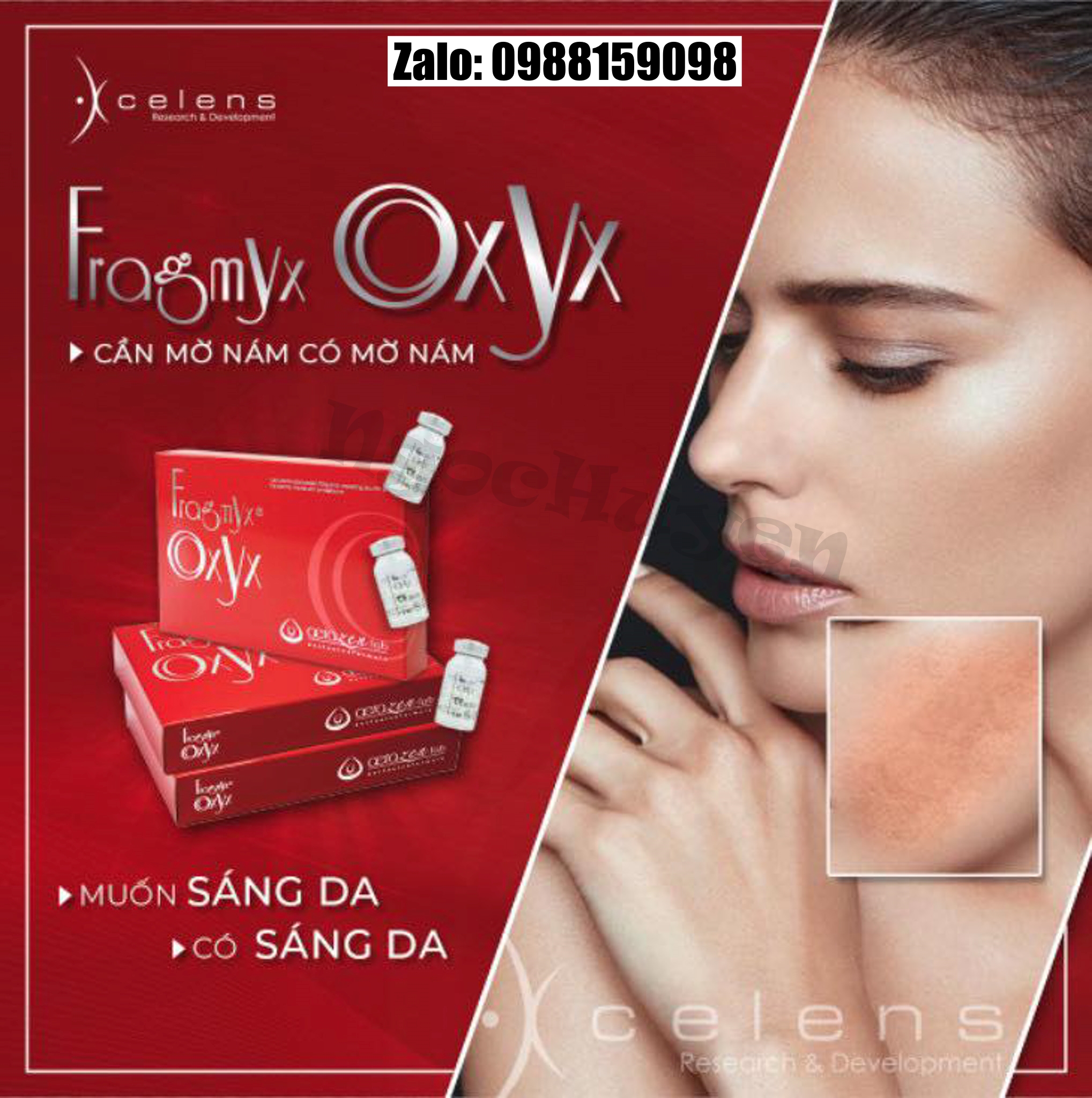 Tinh chất căng bóng da tiêm meso Fragmyx Oxyx – Huyết thanh làm sáng, tái tạo da và ngăn lão hóa - 1 hộp 5 lọ 5ml