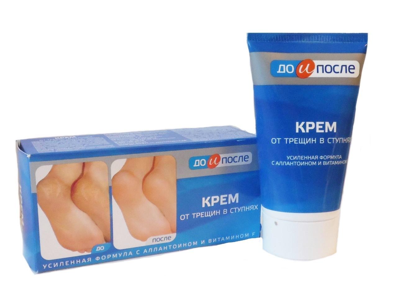 [HCM]Kem Chống Nứt Gót Chân Kpem Cream For Carcks In The Feet 50ml