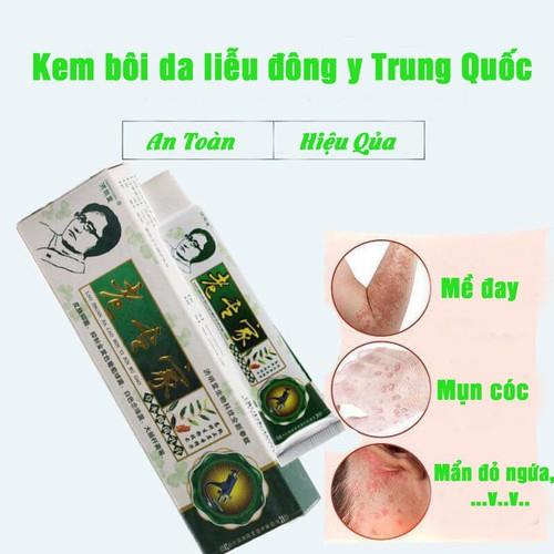 Kem Bôi Ngoài Da Hắc Lào Vảy Nến mề đay á sùng lâu năm tổ đỉa lâu năm