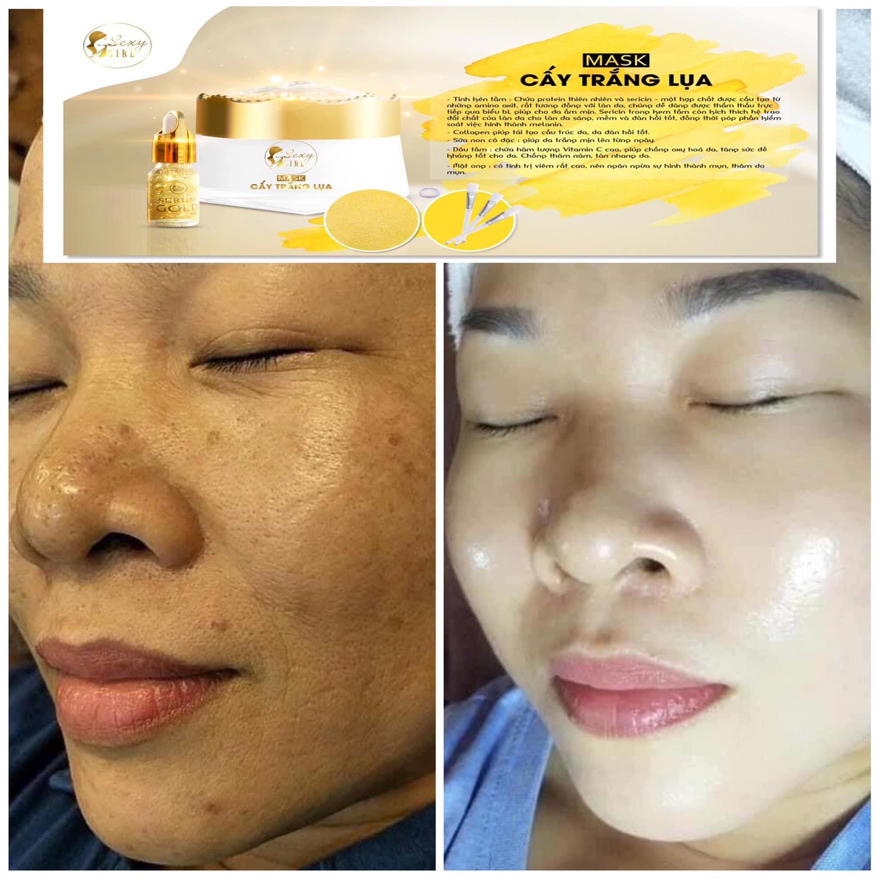 Cấy Trắng Lụa Collagen (Tặng Cọ Quét)