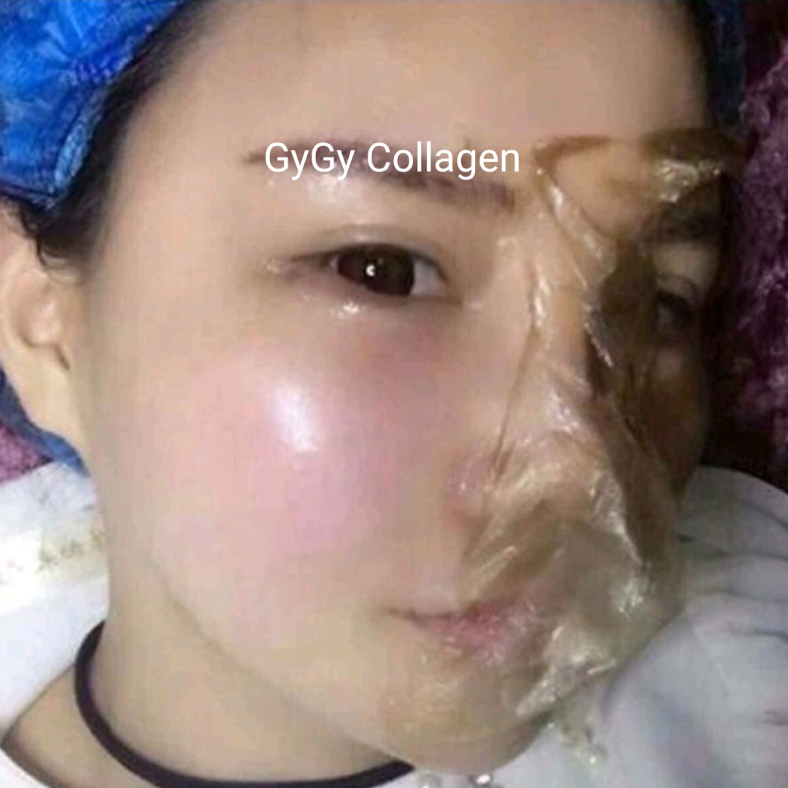 [Hcm]Màng Tế Bào Gốc Collagen Trẻ Hóa Trắng Da Hết Thâm Nám Sạm Gygy