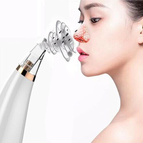 Máy hút mụn đầu đen mini cầm tay