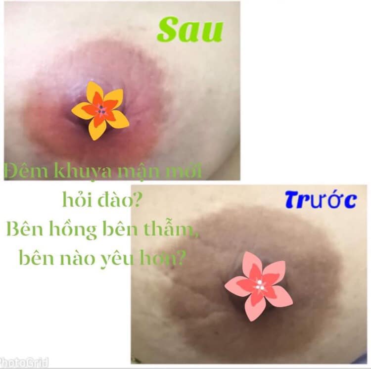 Kem Làm Hồng Nhủ Hoa Ligi