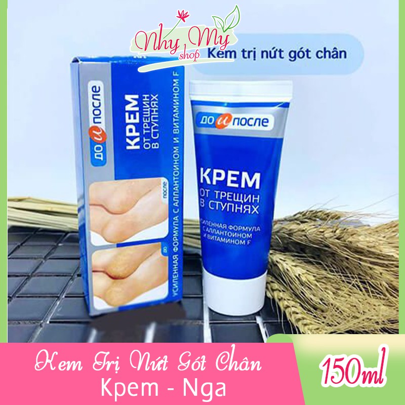 Kem nứt nẻ gót chân kpem (tuýp) sản phẩm tốt với chất lượng độ bền cao và được cam kết sản phẩm y như hình