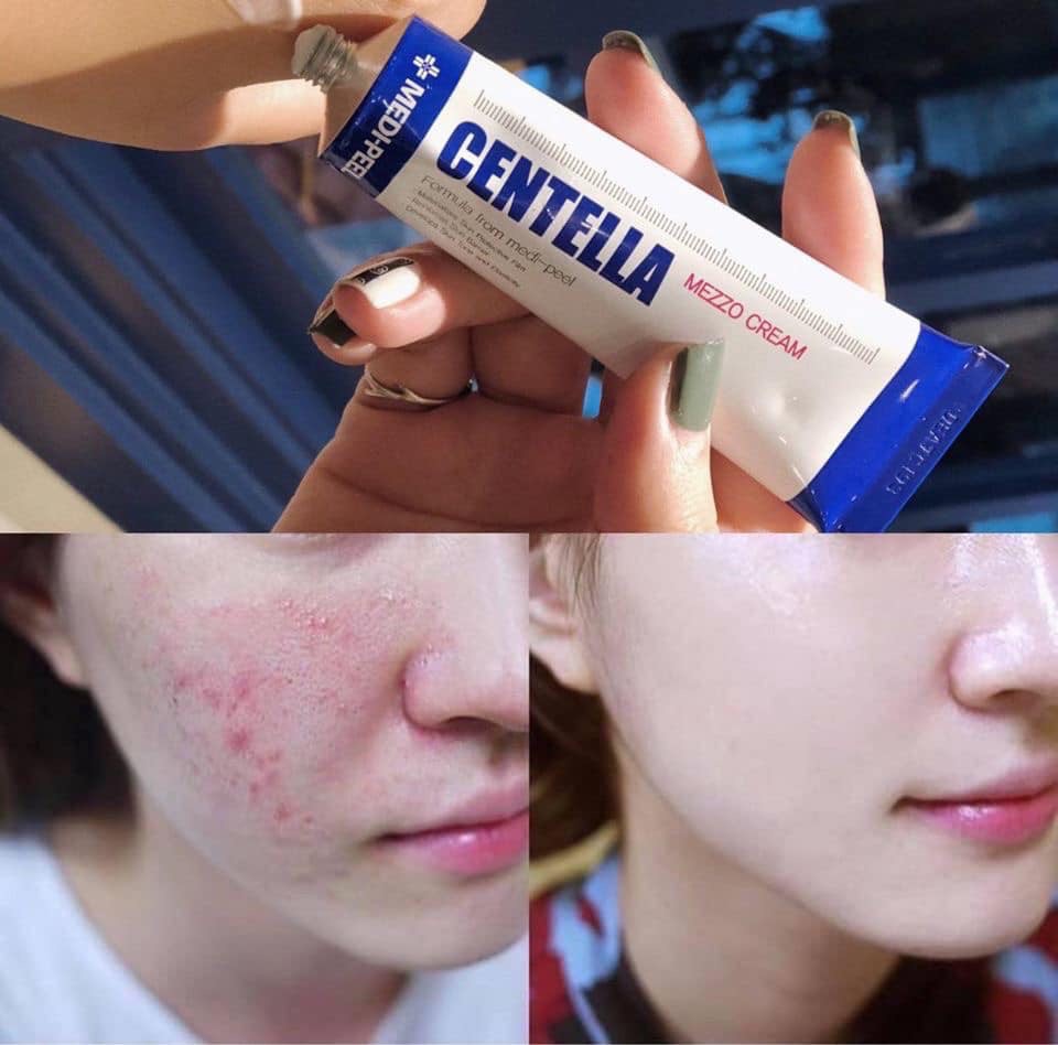 Kem Trị Mụn Thần Thánh Hàn Quốc Medi - Peel Centella Mezzo Cream 30Ml