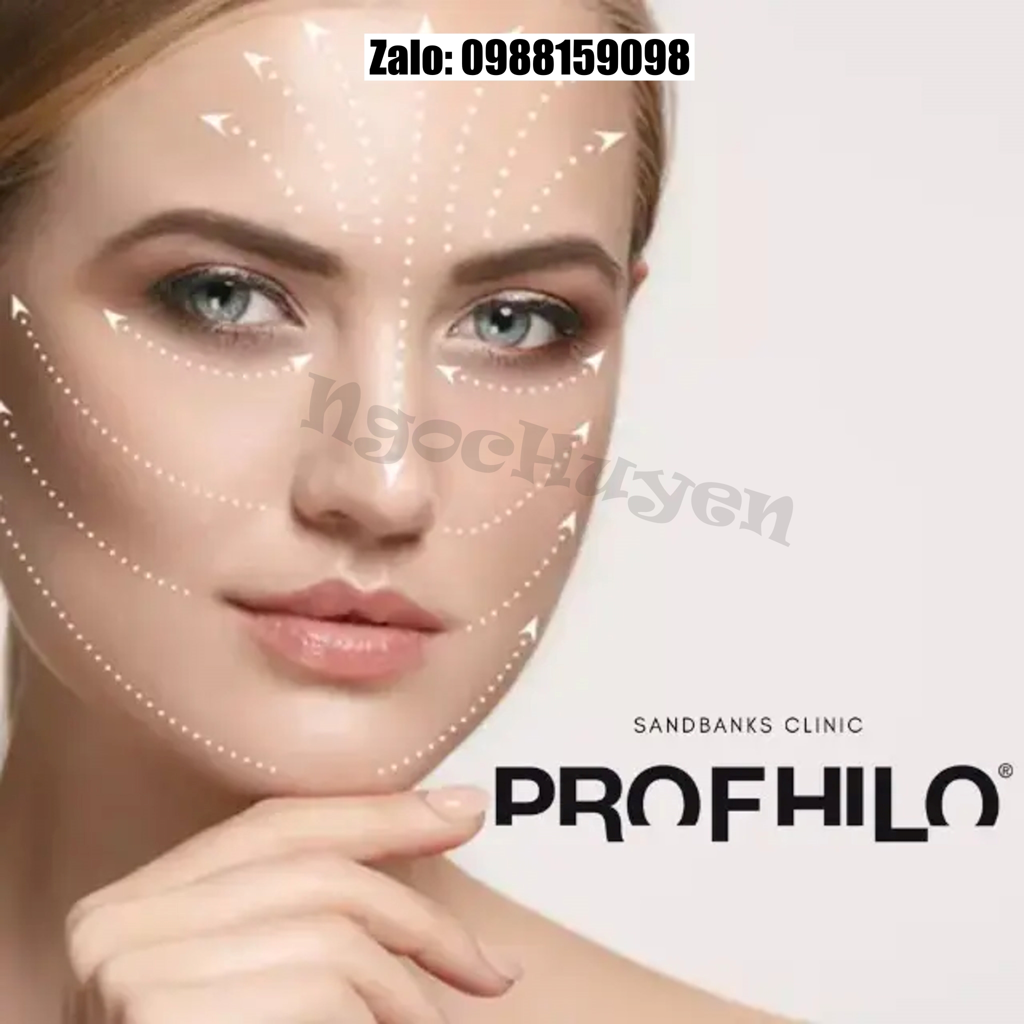 Tinh Chất Profhilo - 1 hộp 1 thanh 2cc - Trẻ Hóa Xóa Nhăn Căng Bóng Da - 2 bản xuất khẩu cty Việt Nam có tem và nội địa Italia