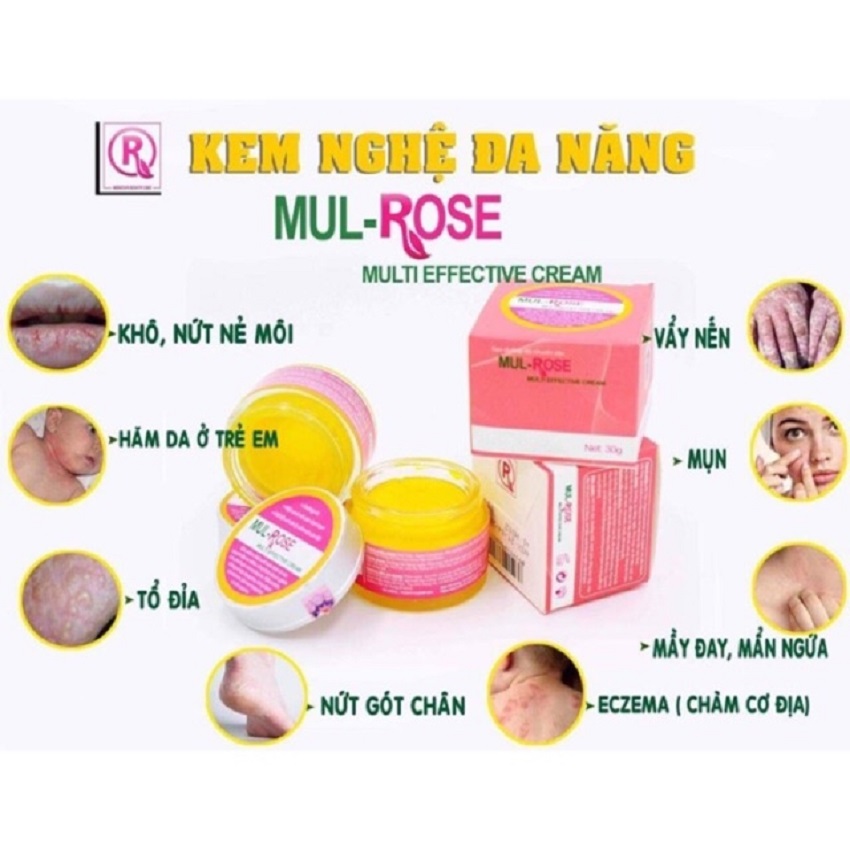 Kem Đa Năng Mul Rose Hết Viêm Da Cơ Địa Nứt Gót Chân Chàm Sữa Hăm Thủy Đậu Và Rạn Da - 30Gr