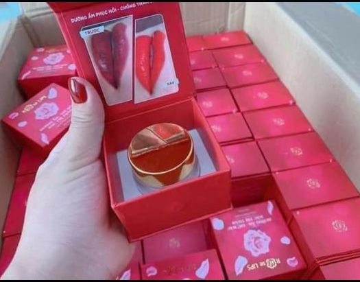 Dưỡng Môi Đặc Trị Thâm Loang Rose Lips