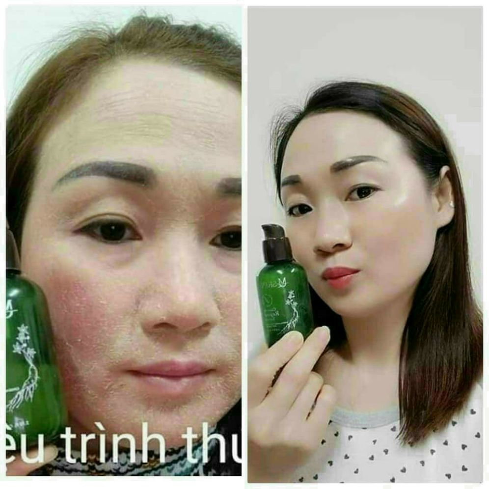 Serum Tái Tạo Nhân Sâm Mq Skin Chính Hãng 100% Tái Tạo Làn Da Mới Trắng Mịn Sạch Mụn Nám