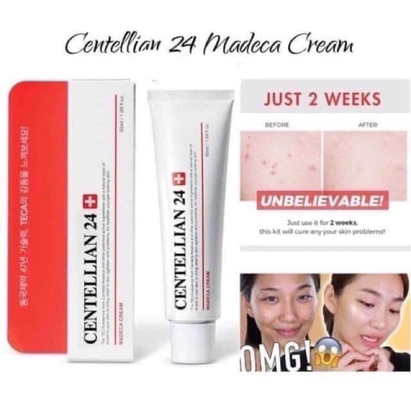 Kem Dưỡng Rau Má Ngừa Mụn Và Thâm Sẹo Centellian 24+ Madeca Cream