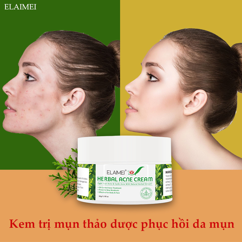 Trị mụn nhanh chóng ELAIMEI Kem dưỡng da 50g giàu công thức thảo dược thiên nhiên giúp loại bỏ mụn hiệu quả giúp da trắng sáng tự nhiên（kem ngừa mụn.giảm mụn.giảm thâm trắng da.làm mịn da）