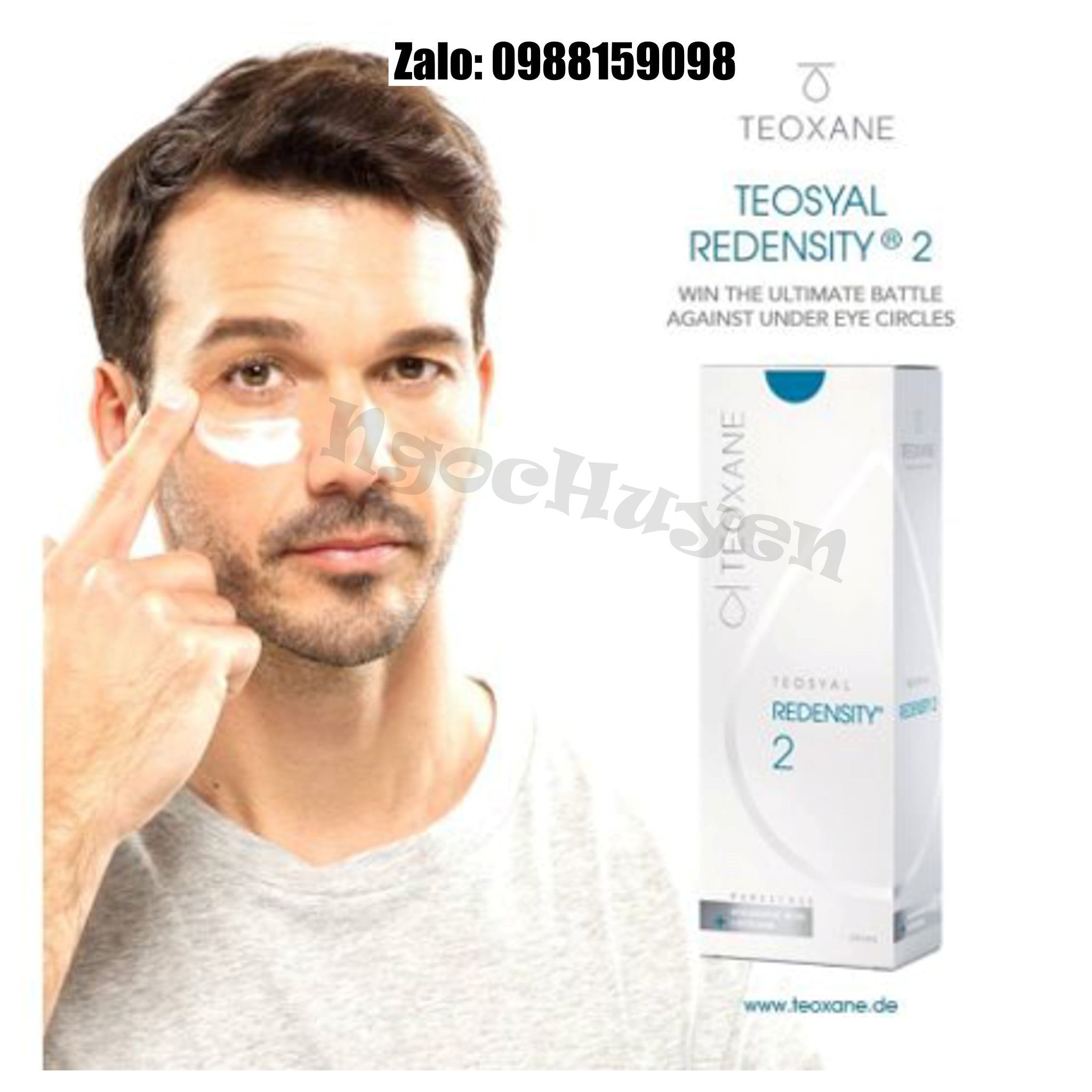 Tan Quầng Thâm Mắt Teoxane 2 - 1 hộp 2cc - Filler Mắt