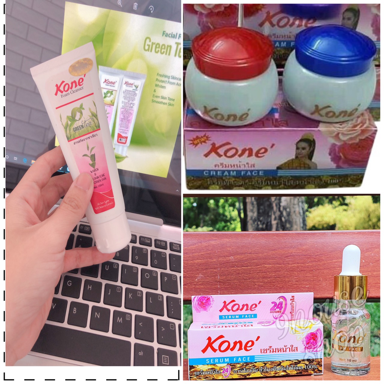 Bộ 3 Sản Phẩm Kone Thái Lan Dưỡng Da Trắng Hồng Gồm Bộ Kem Kone Ngày Đêm 1 Lọ Serum Dưỡng Da 1 Sửa Rửa Mặt Trà Xanh Vừa Giúp Lan Da Mịn Màng Vừa Tiết Kiệm Chi Phí (Hàng Thái Lan 100%)