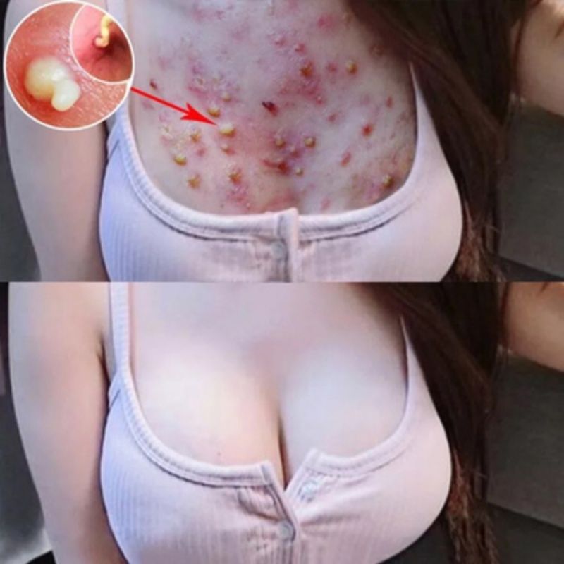 Kem dưỡng ẩm Aloe Vera Gel Cream After Sun Repair 40g Cả nam và nữ đều có thể sử dụng sản phẩm chăm sóc da