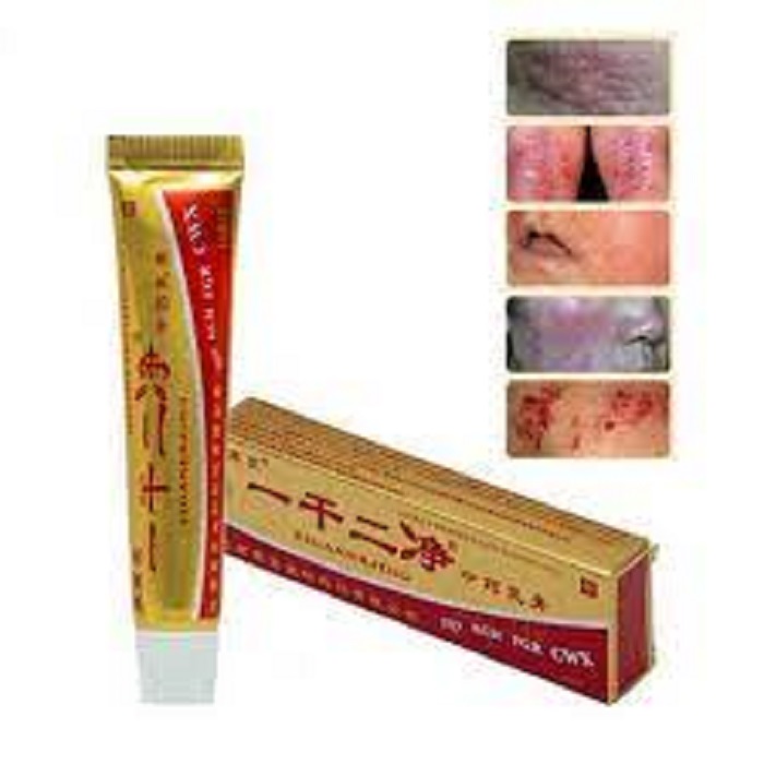 Kem bôi trị mẩn ngứa viêm da cơ địa viêm da dị ứng - chính hãng